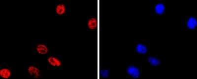 Immunocytochemistry/ Immunofluorescence: MITF Antibody (JF100-01) [NBP2-66951]