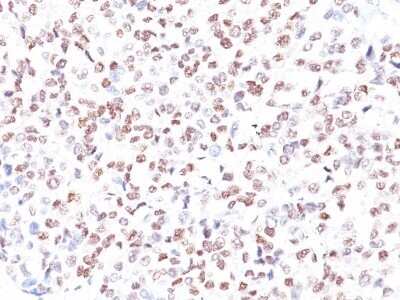 Immunohistochemistry-Paraffin: MITF Antibody (MITF/915) [NBP2-45161]