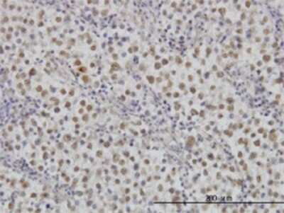 Immunohistochemistry-Paraffin: MKK3/MEK3 Antibody (1D10) [H00005606-M02]