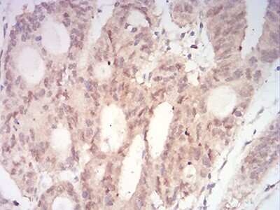 Immunohistochemistry: MKK3/MEK3 Antibody (2E12D11) - BSA Free [NBP2-52508]