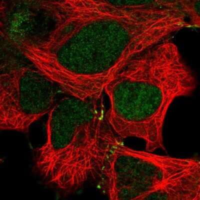 Immunocytochemistry/ Immunofluorescence: MKK4/MEK4 Antibody [NBP2-57194]