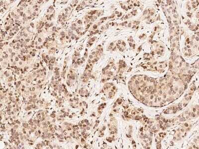 Immunohistochemistry-Paraffin: MKK4/MEK4 Antibody [NBP2-99331]