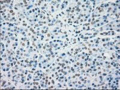 Immunohistochemistry: MKK4/MEK4 Antibody (OTI8A8) - Azide and BSA Free [NBP2-72710]