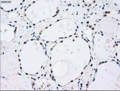 Immunohistochemistry: MKK4/MEK4 Antibody (OTI8A8) - Azide and BSA Free [NBP2-72710]