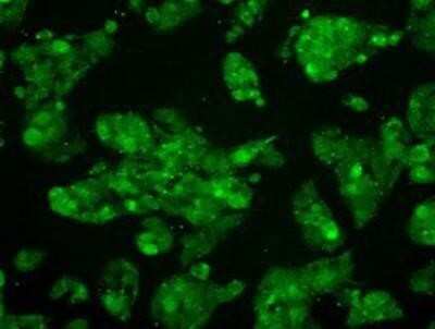 Immunocytochemistry/ Immunofluorescence: MKK4/MEK4 Antibody (OTI8A8) [NBP1-47839]