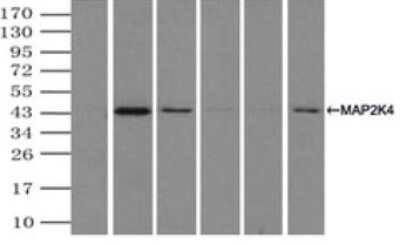 Immunoprecipitation: MKK4/MEK4 Antibody (OTI8A8) [NBP1-47839]