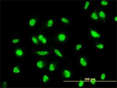 Immunocytochemistry/ Immunofluorescence: MKK6/MEK6 Antibody (2F2) [H00005608-M02]