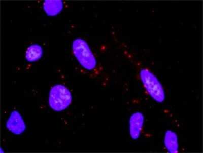 Proximity Ligation Assay: MKK6/MEK6 Antibody (2F2) [H00005608-M02]