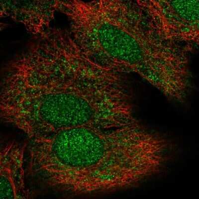 Immunocytochemistry/ Immunofluorescence: MKK6/MEK6 Antibody [NBP1-87791]