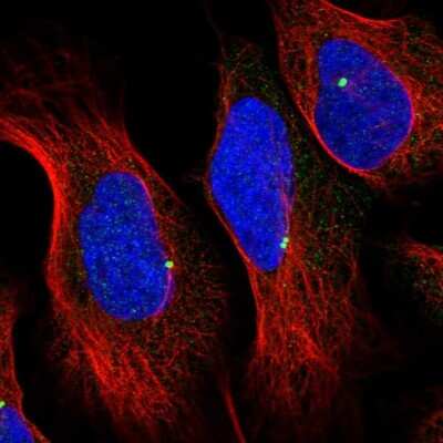 Immunocytochemistry/ Immunofluorescence: MKKS Antibody [NBP1-92123]