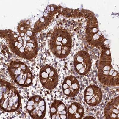 Immunohistochemistry-Paraffin: MKKS Antibody [NBP1-92123]