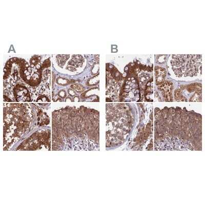 Immunohistochemistry-Paraffin: MKKS Antibody [NBP1-92123]
