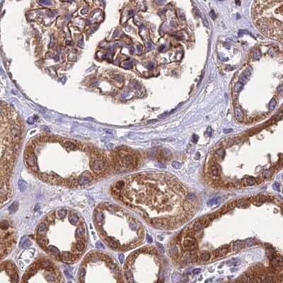 Immunohistochemistry-Paraffin: MKKS Antibody [NBP1-92123]