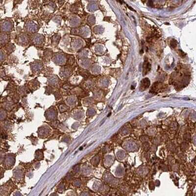 Immunohistochemistry-Paraffin: MKKS Antibody [NBP1-92123]
