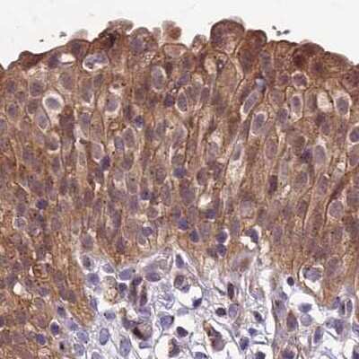 Immunohistochemistry-Paraffin: MKKS Antibody [NBP1-92123]