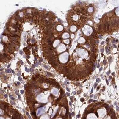 Immunohistochemistry-Paraffin: MKKS Antibody [NBP1-92123]