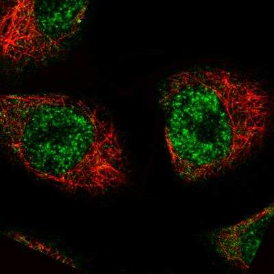 Immunocytochemistry/ Immunofluorescence: MKL2 Antibody (CL1546) [NBP2-52970]