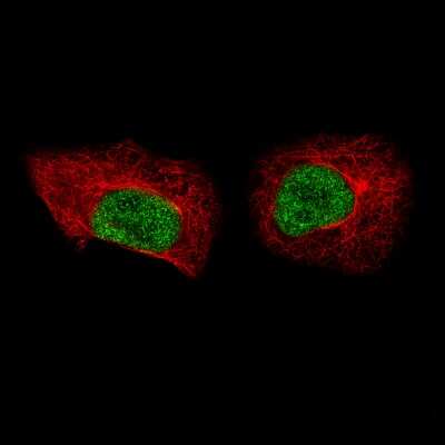 Immunocytochemistry/ Immunofluorescence: MKL2 Antibody (CL1546) [NBP2-52970]