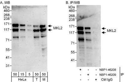 Western Blot: MKL2 Antibody [NBP1-46209]