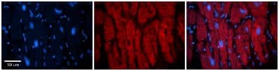 Immunohistochemistry: MKLP1 Antibody [NBP1-58126]