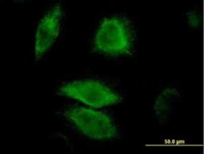 Immunocytochemistry/ Immunofluorescence: MKP-3/DUSP6 Antibody (3G2) [H00001848-M01]