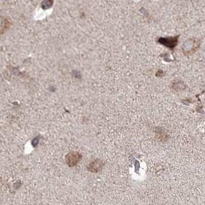 Immunohistochemistry-Paraffin: MKRN2 Antibody [NBP1-83179]