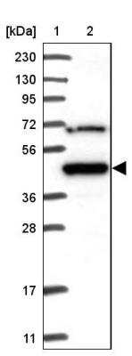 Western Blot: MKRN2 Antibody [NBP1-83178]
