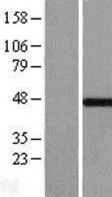 Western Blot: MKRN2 Overexpression Lysate [NBL1-13127]