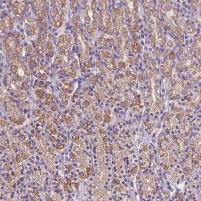 Immunohistochemistry-Paraffin: MKRN2OS Antibody [NBP2-49462]