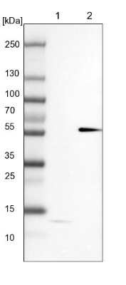 Western Blot: MKS1 Antibody [NBP1-88692]