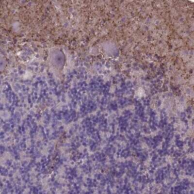 Immunohistochemistry-Paraffin: MLC1 Antibody [NBP1-81555]