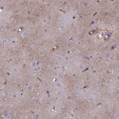 Immunohistochemistry-Paraffin: MLC1 Antibody [NBP1-81555]