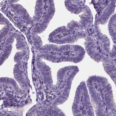 Immunohistochemistry-Paraffin: MLC1 Antibody [NBP1-81555]