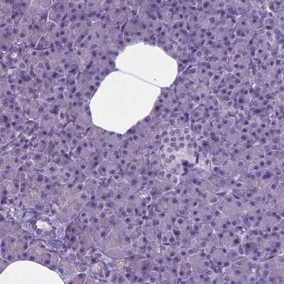 Immunohistochemistry-Paraffin: MLC1 Antibody [NBP1-81555]