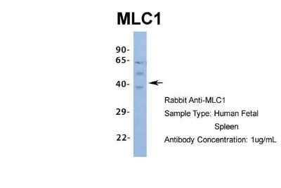 Western Blot: MLC1 Antibody [NBP1-80073]