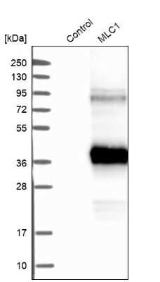 Western Blot: MLC1 Antibody [NBP1-81555]