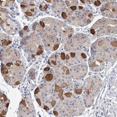 Immunohistochemistry-Paraffin: MLC1SA Antibody [NBP1-92124]