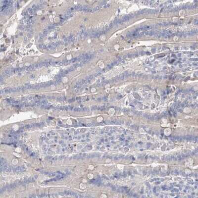 Immunohistochemistry-Paraffin: MLC1SA Antibody [NBP1-92124]