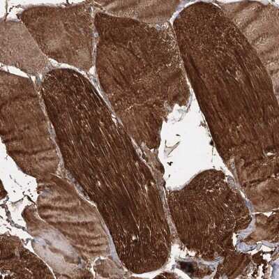 Immunohistochemistry-Paraffin: MLC1SA Antibody [NBP1-92124]