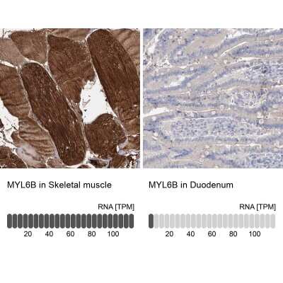 Immunohistochemistry-Paraffin: MLC1SA Antibody [NBP1-92124]