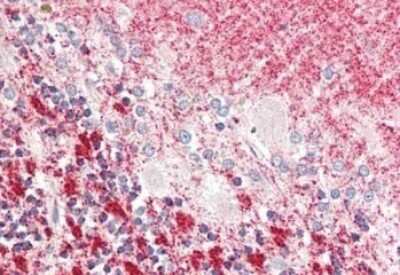 Immunohistochemistry: MLF1 Interacting Protein Antibody - N-terminal [NB110-85541]