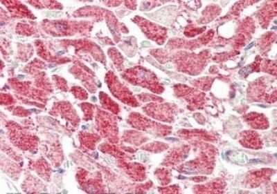 Immunohistochemistry: MLF1 Interacting Protein Antibody - N-terminal [NB110-85541]