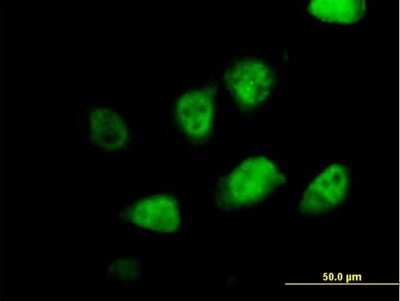 Immunocytochemistry/ Immunofluorescence: MLF2 Antibody [H00008079-B01P]