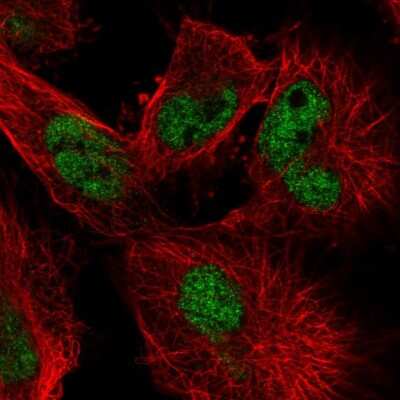 Immunocytochemistry/ Immunofluorescence: MLH1 Antibody [NBP2-38677]
