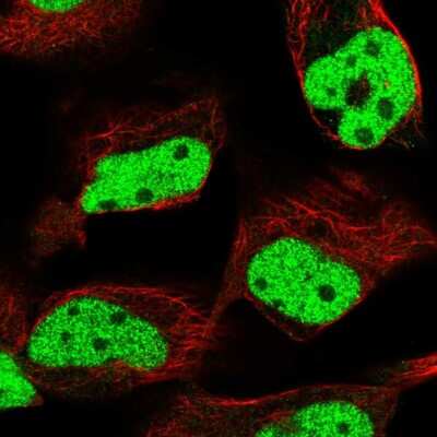 Immunocytochemistry/ Immunofluorescence: MLH1 Antibody [NBP2-56287]