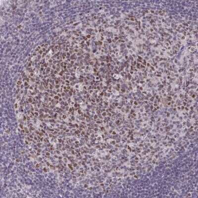 Immunohistochemistry-Paraffin: MLH1 Antibody [NBP2-38677]