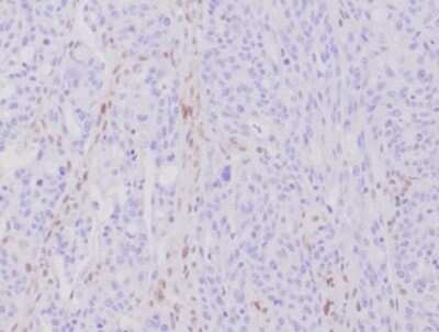 Immunohistochemistry-Paraffin: MLH1 Antibody (MLH1/6284R) [NBP3-13971]