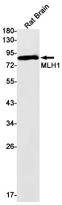 Western Blot: MLH1 Antibody (S05-1G4) [NBP3-19694]