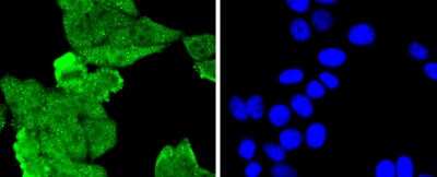 Immunocytochemistry/ Immunofluorescence: MLH1 Antibody (SP08-04) [NBP2-67381]