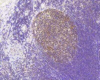 Immunohistochemistry-Paraffin: MLH1 Antibody (SP08-04) [NBP2-67381]